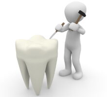 tooth, dentist, close up-1015409.jpg