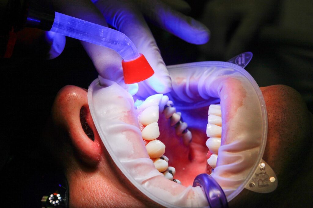 teeth whitening in turkey prices Compared to the U.S. - U.K. & EU