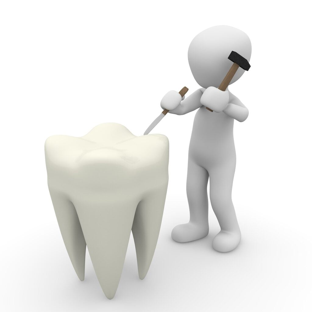 Teeth Whitening for Older Adults - On existing dental restorations